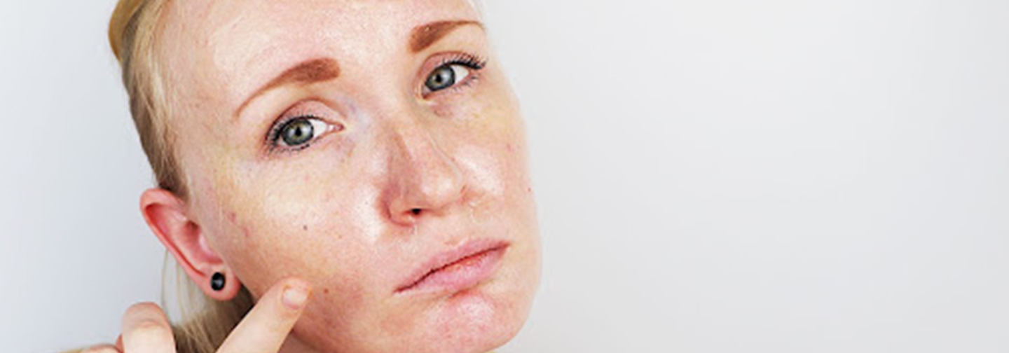 unsatisfied lady | skin feels greasy after moisturizer